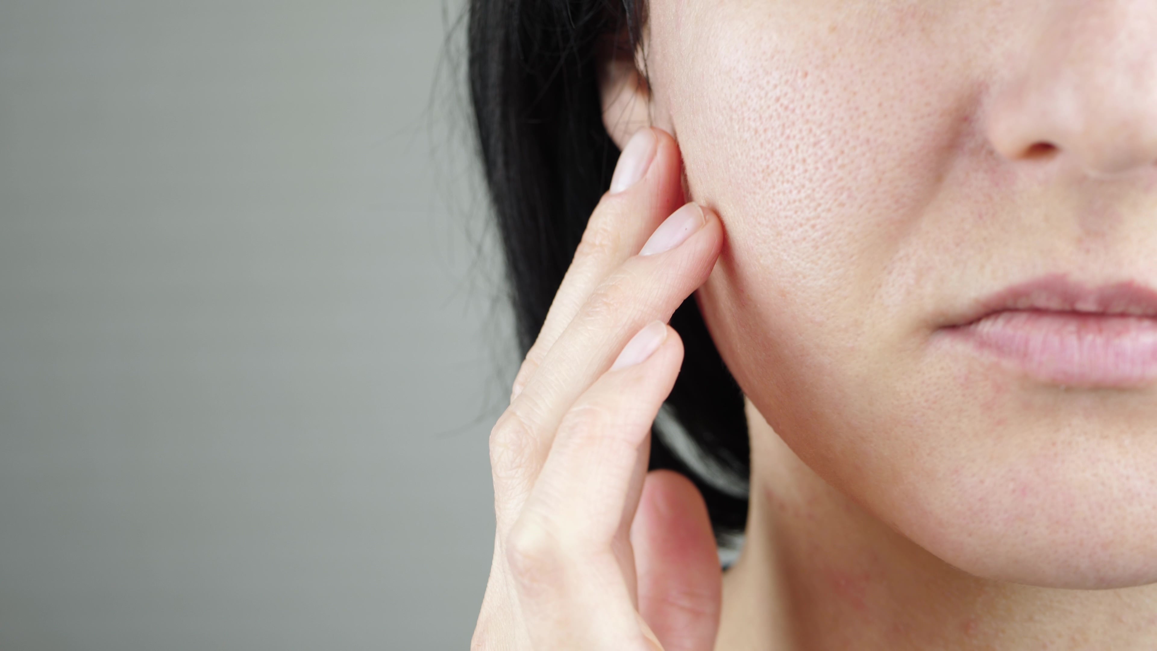 Sebum and Acne Averr Aglow