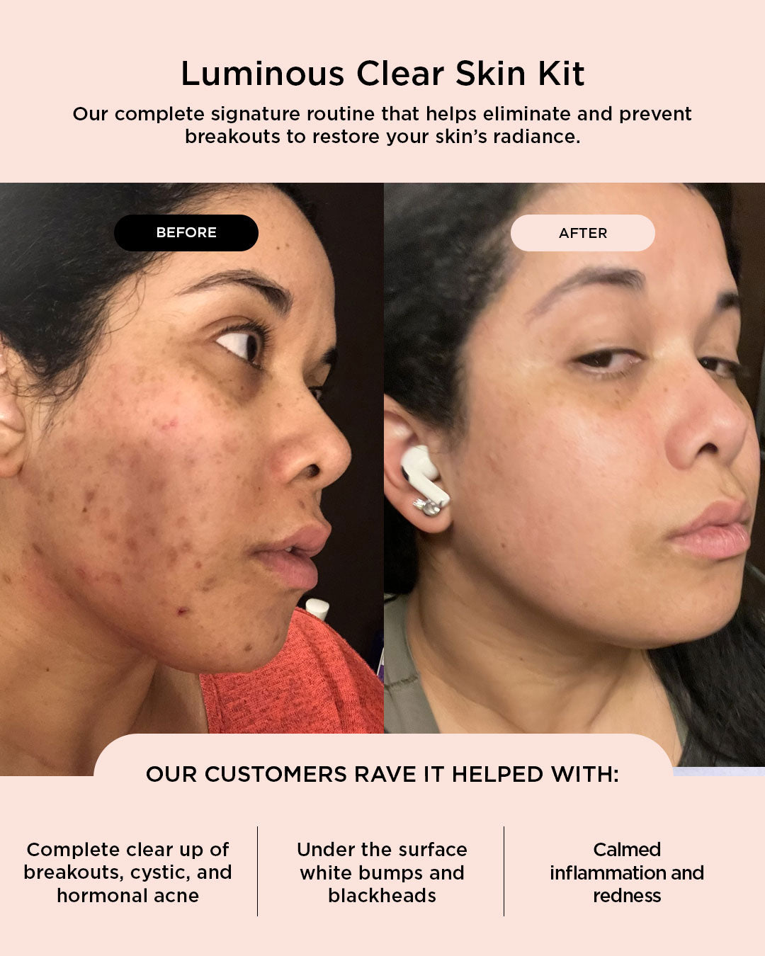 (Black Friday Special) Luminous Clear Skin Bundle