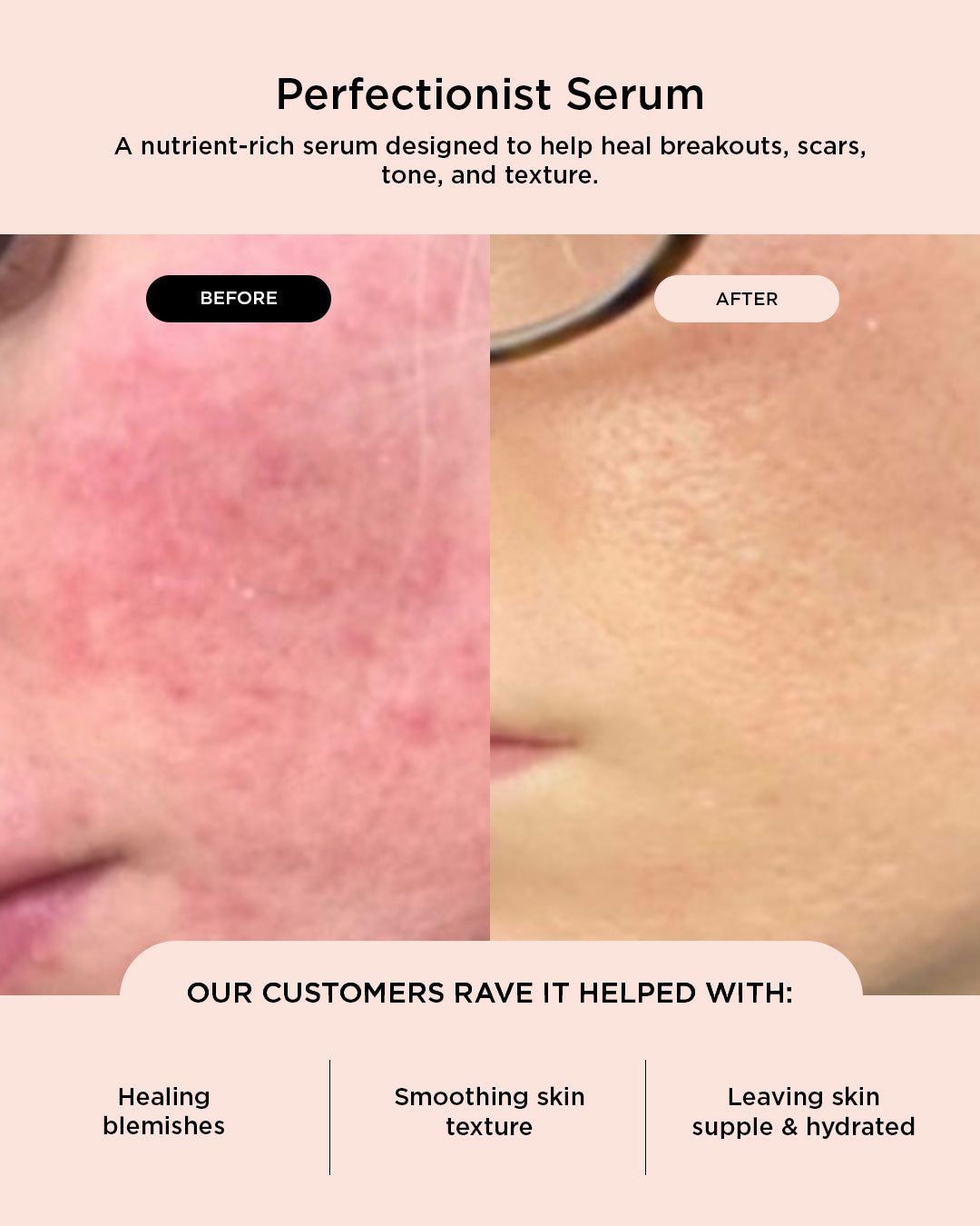 Perfectionist Serum