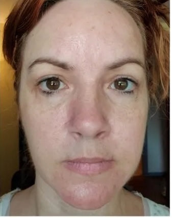Customer result, after