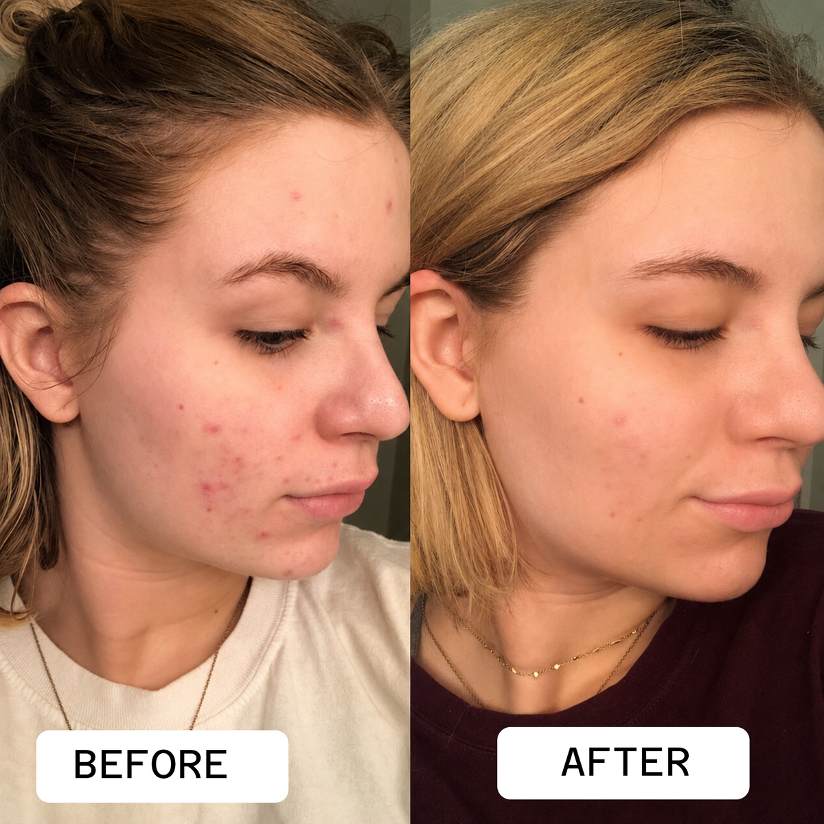 Clear Skin Cleansing Duo