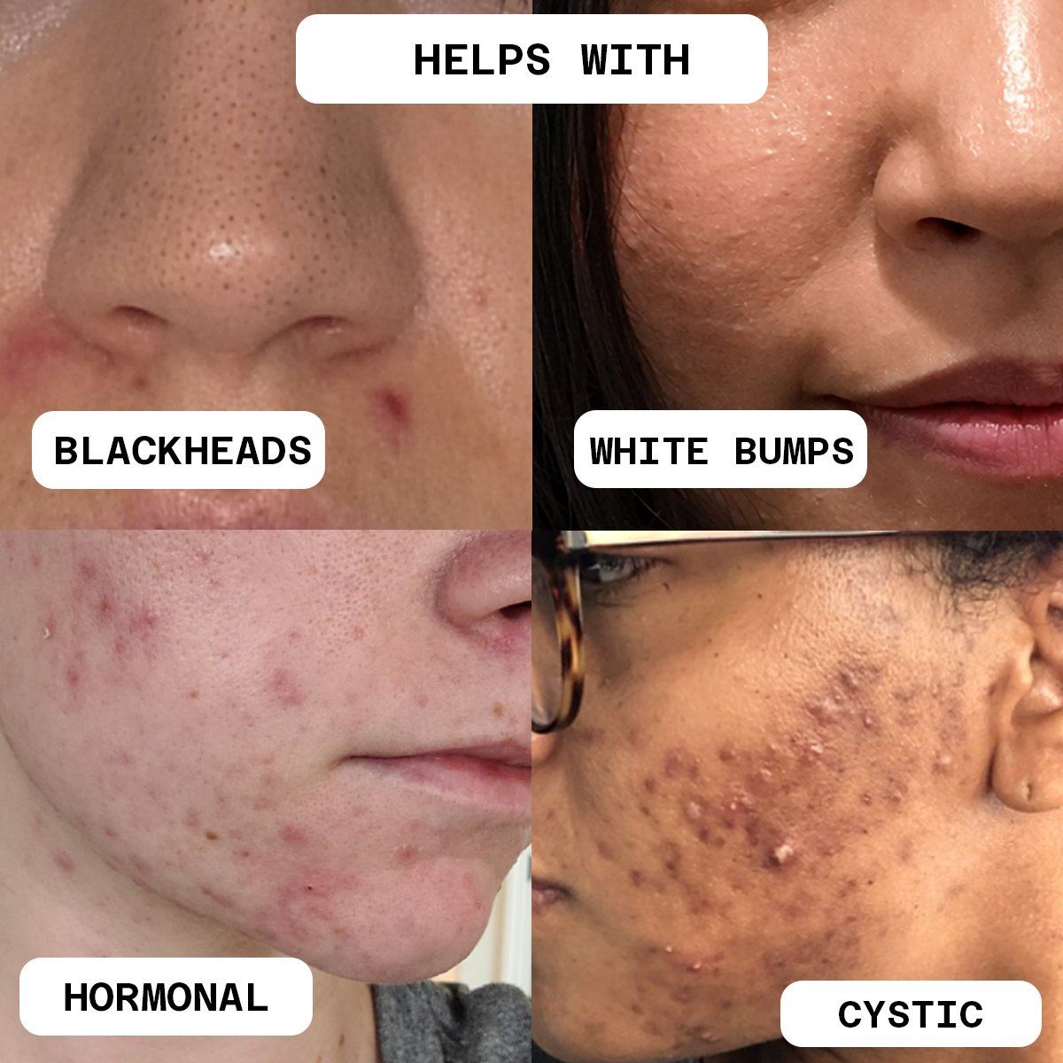 Clear Skin Elixir