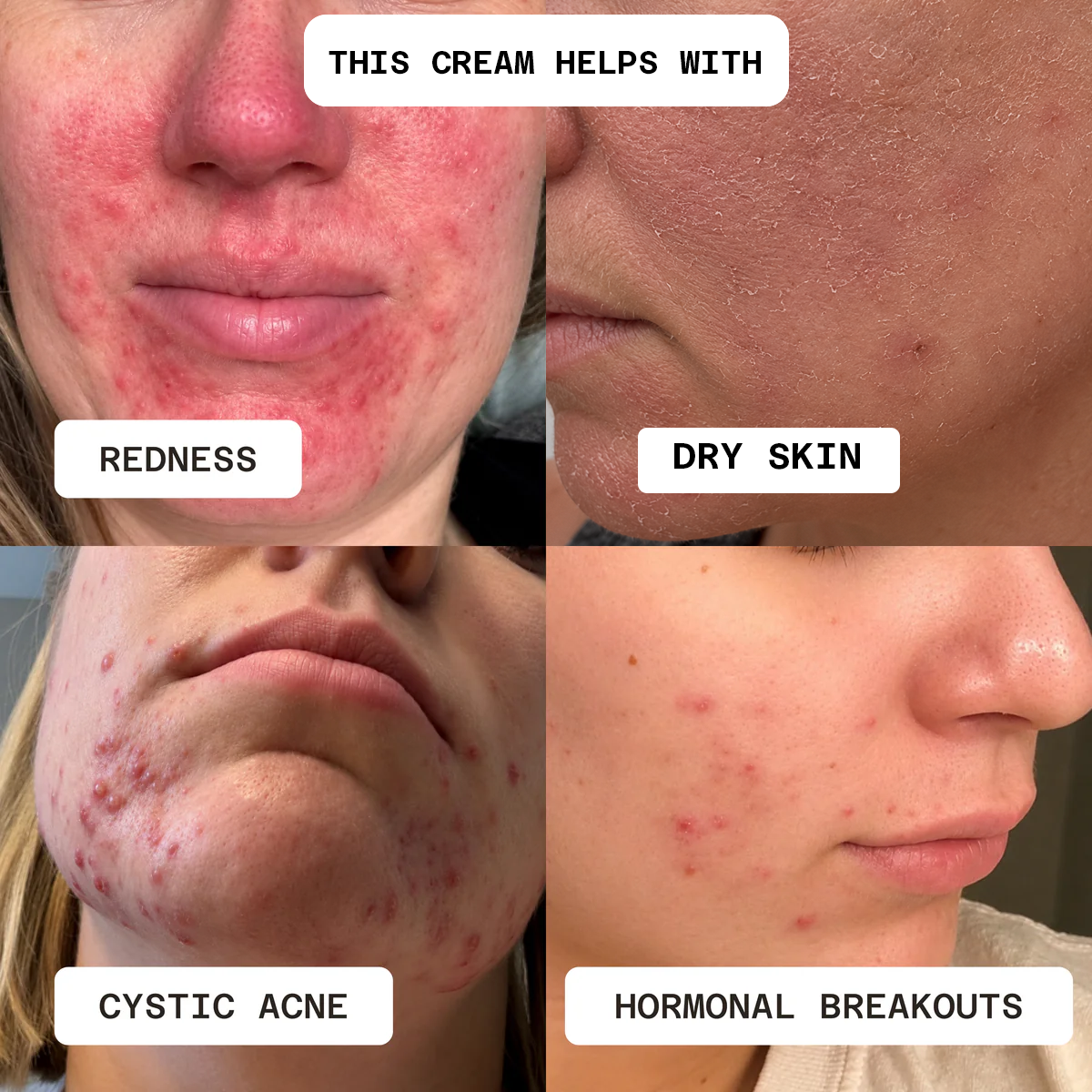 Flawless Nourishment Cream