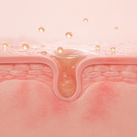 Root Cause: Stripped, Reactive Skin