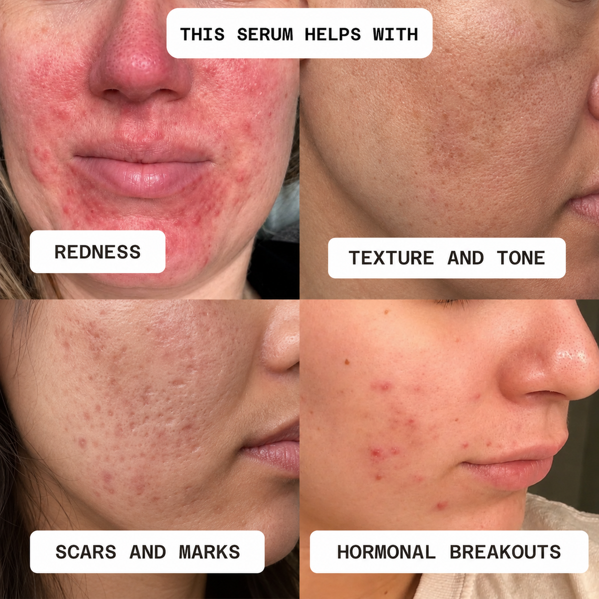 Perfectionist Serum