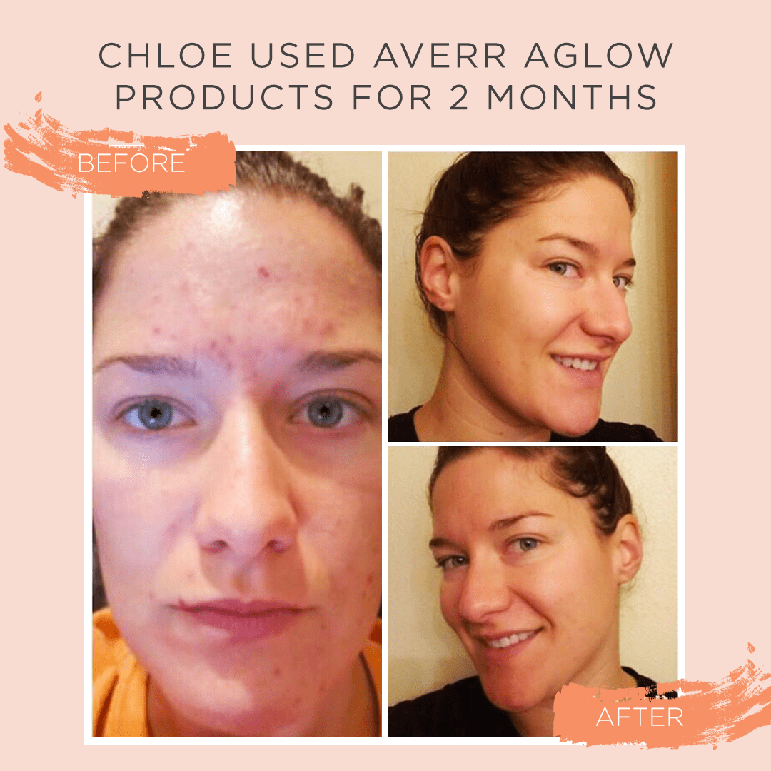 Clarifying Hydration Dew Averr Aglow