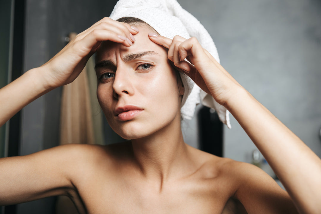 What Causes Acne? Averr Aglow