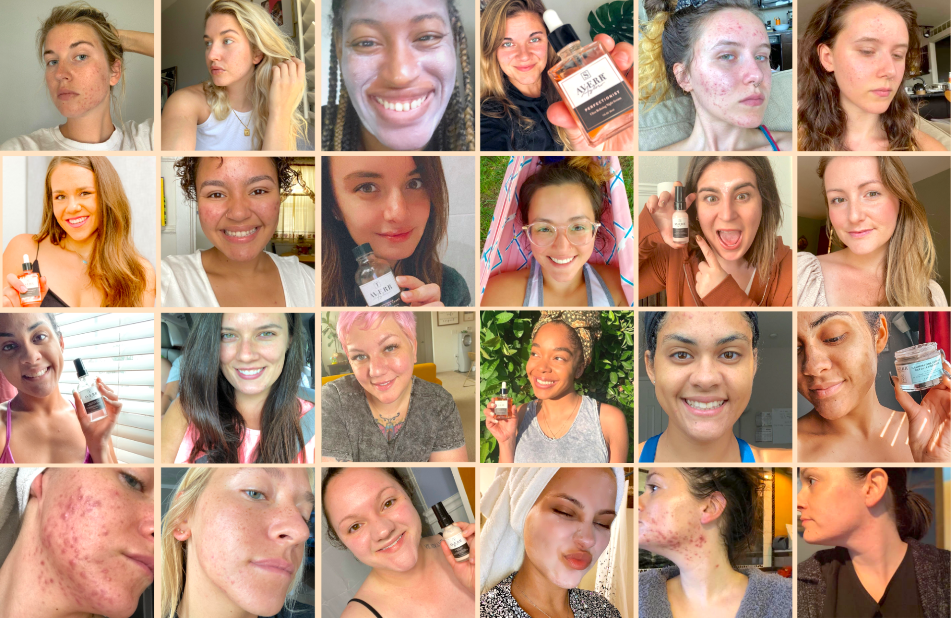 19 Incredible Skin Acne Transformations from Averr Aglow®