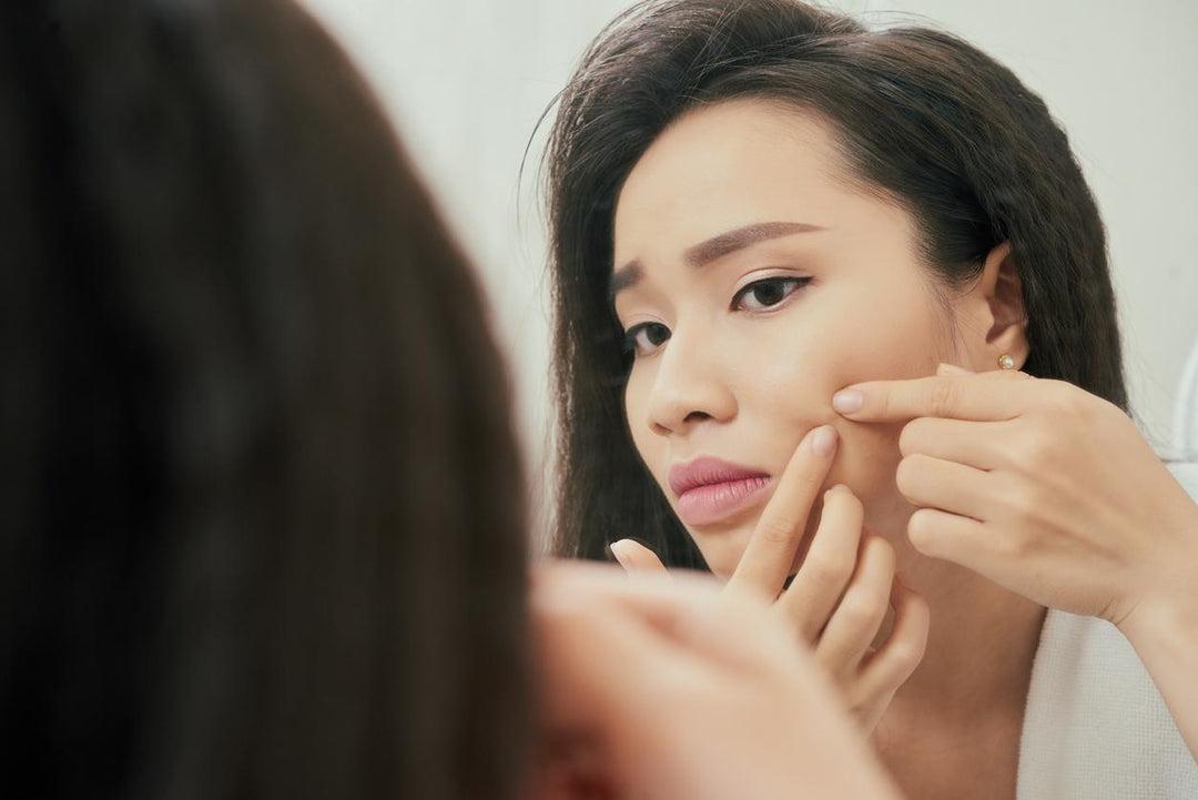 Is Pimple Popping Safe? Averr Aglow
