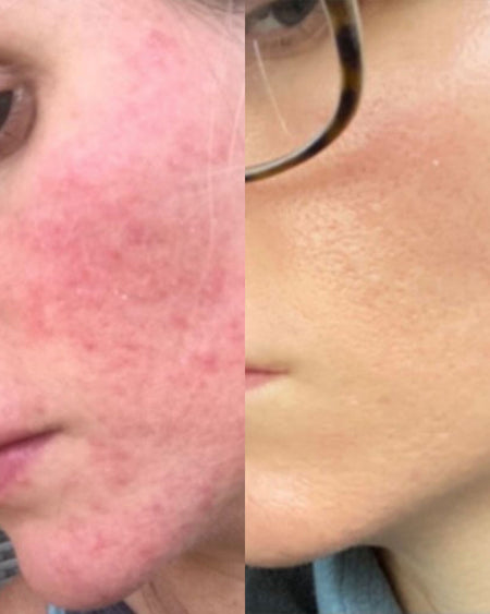 Perfectionist Serum