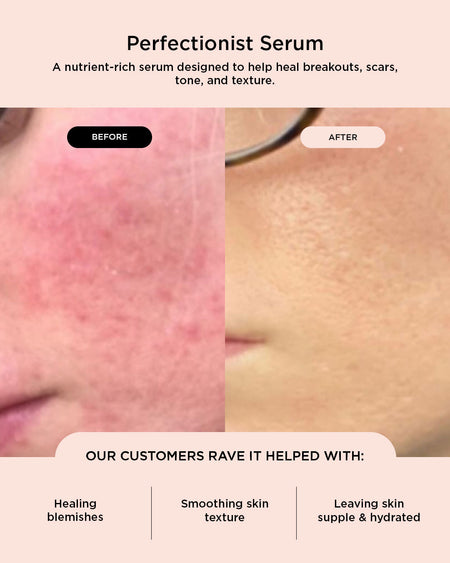 Perfectionist Serum