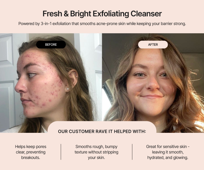 Fresh & Bright Exfoliating Cleanser
