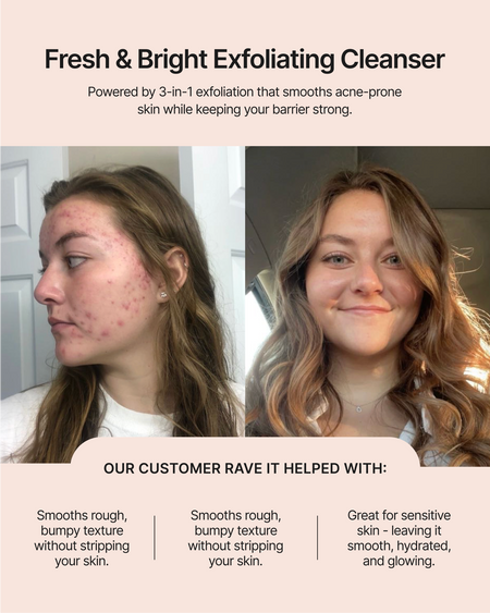 Fresh & Bright Exfoliating Cleanser