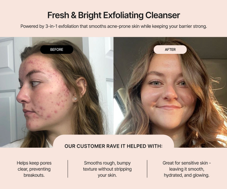 Fresh & Bright Exfoliating Cleanser