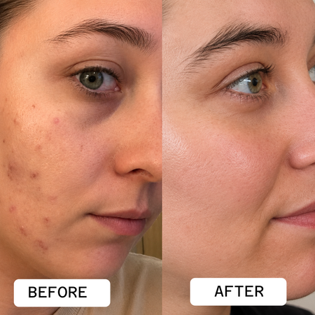 Flawless Nourishment Cream