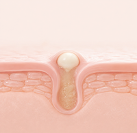 The Fear of Clogged Pores