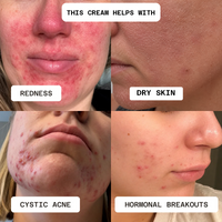 Flawless Nourishment Cream
