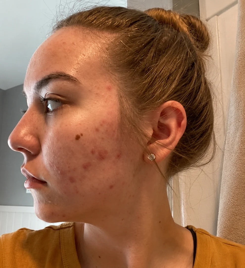 DAY 7-14