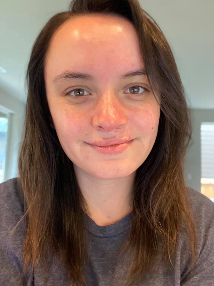 After — 90 Days