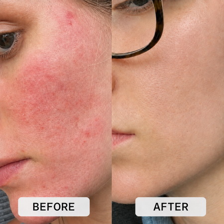 Perfectionist Serum