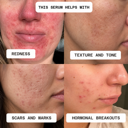 Perfectionist Serum