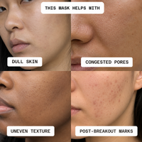 Brightening + Resurfacing Mask