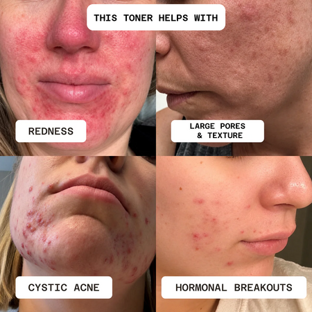 Luminous Complexion Toner