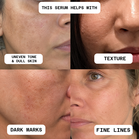 20% Vitamin C Serum