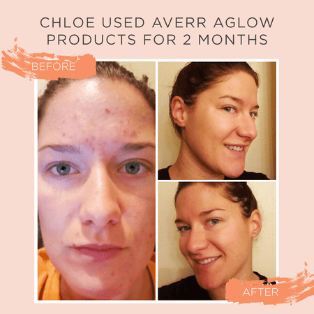 Clarifying Hydration Dew Averr Aglow