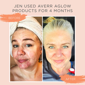 Luminous Clear Skin Kit