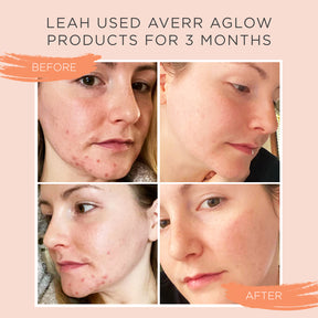 No.3 Clear Skin Elixir